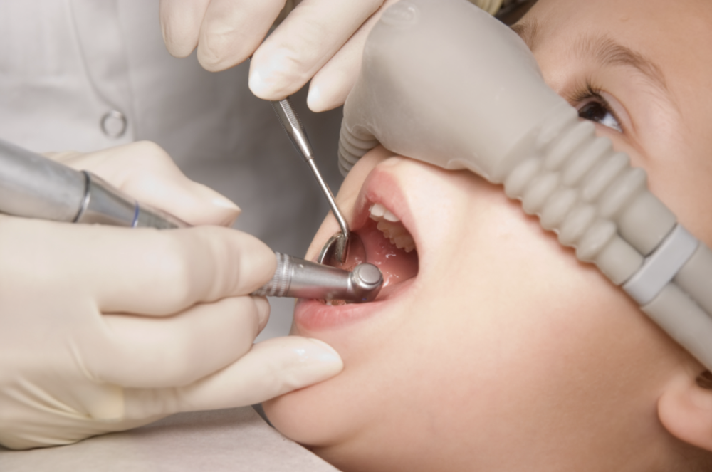 A kid getting sedated during tooth extraction treatment in Birmingham, AL