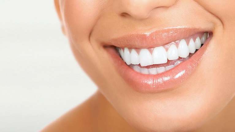 A smiling patient after a veneer treatment