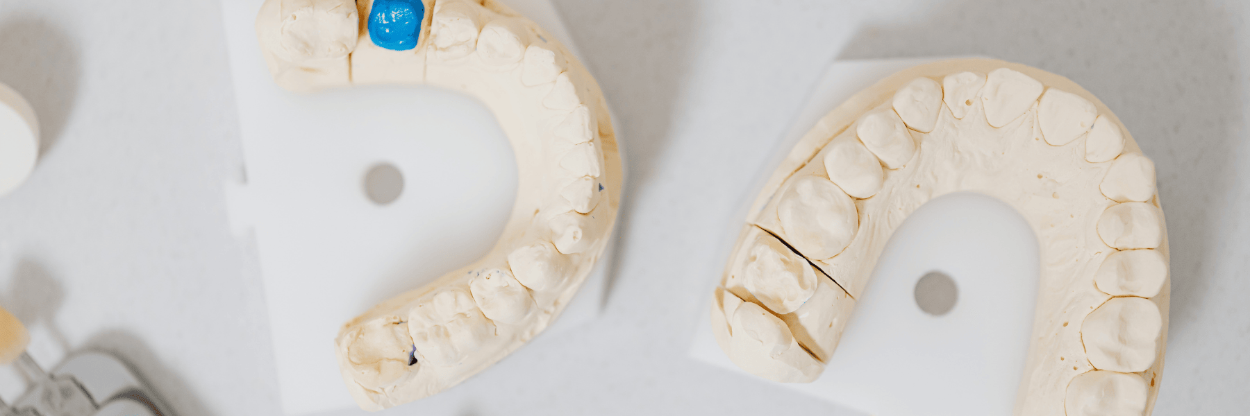 Woman with dental crowns smiling