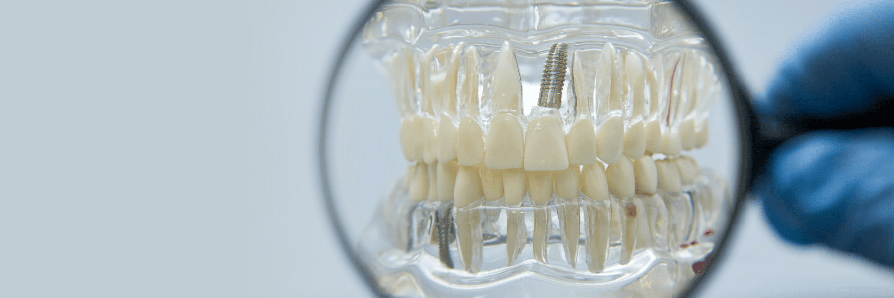Woman with natural looking dental implant