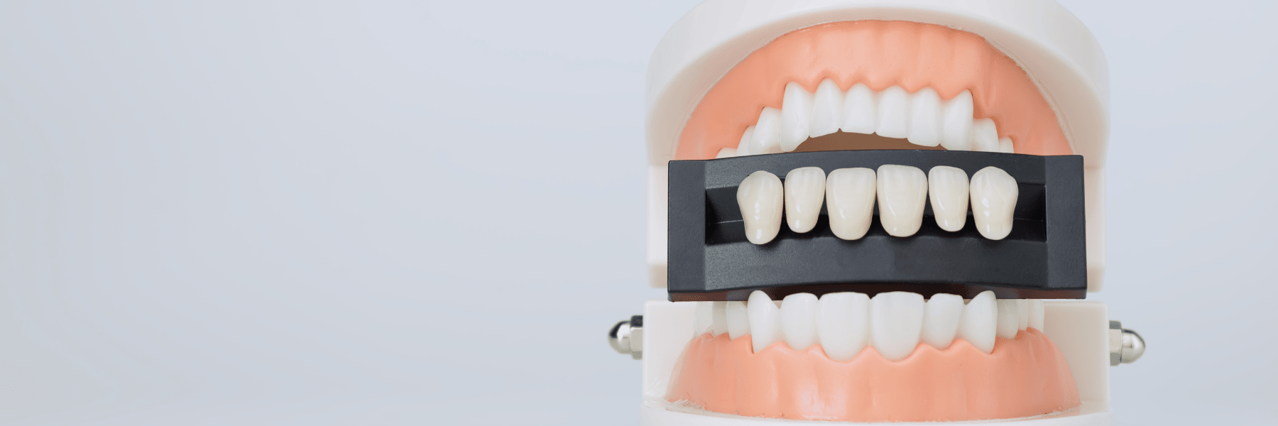 Man with porcelain veneers in Birmingham
