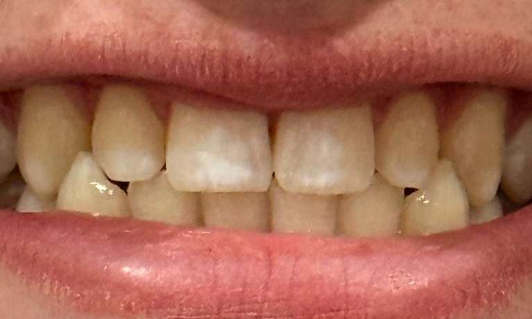 Another-great-Zoom-result-Before-Image