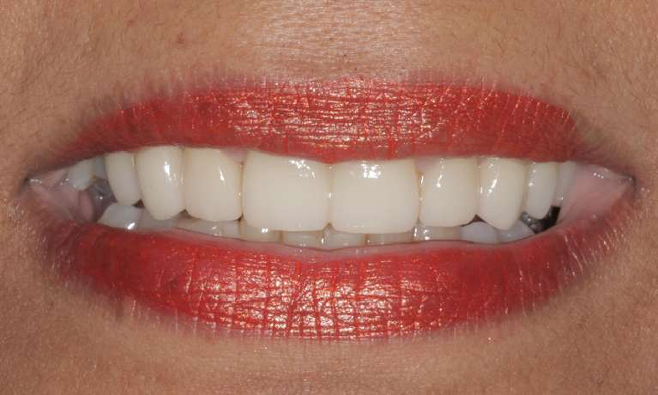 Cook Family and Cosmetic Dentistry