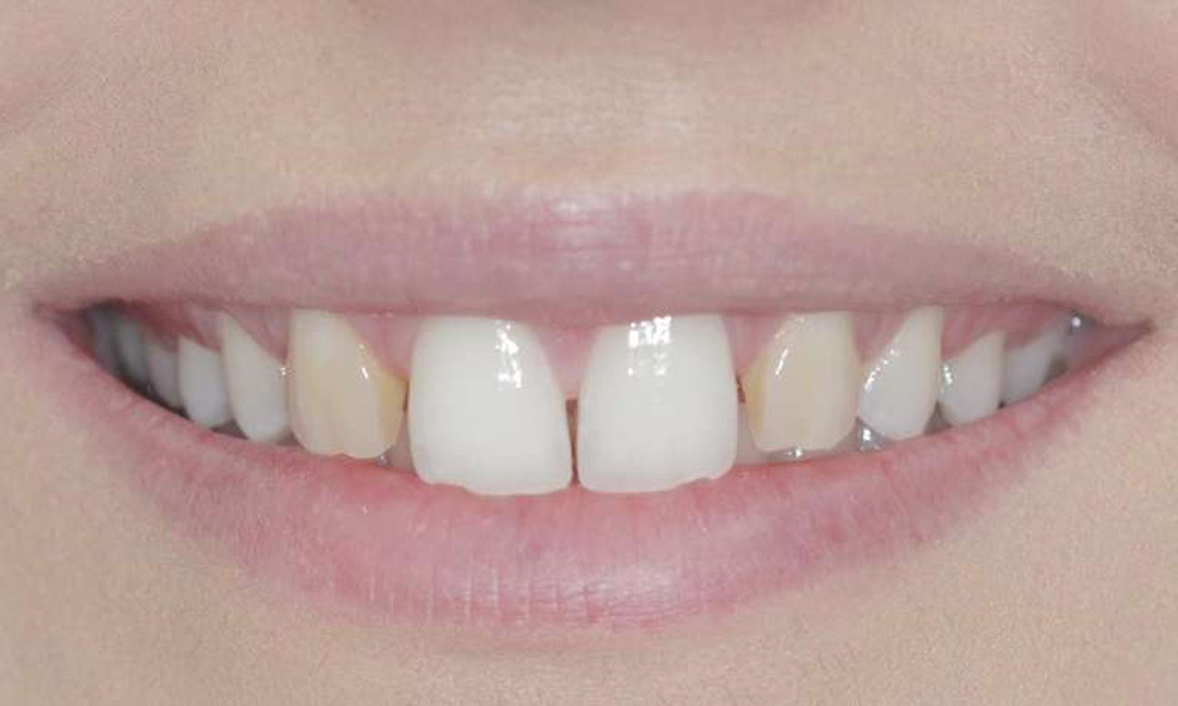 Cook Family and Cosmetic Dentistry